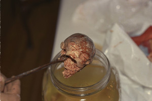 abortionpic2headfront800x534-300×200